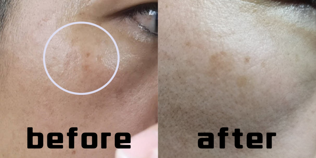 男性の美容を考えるピカメンブログ