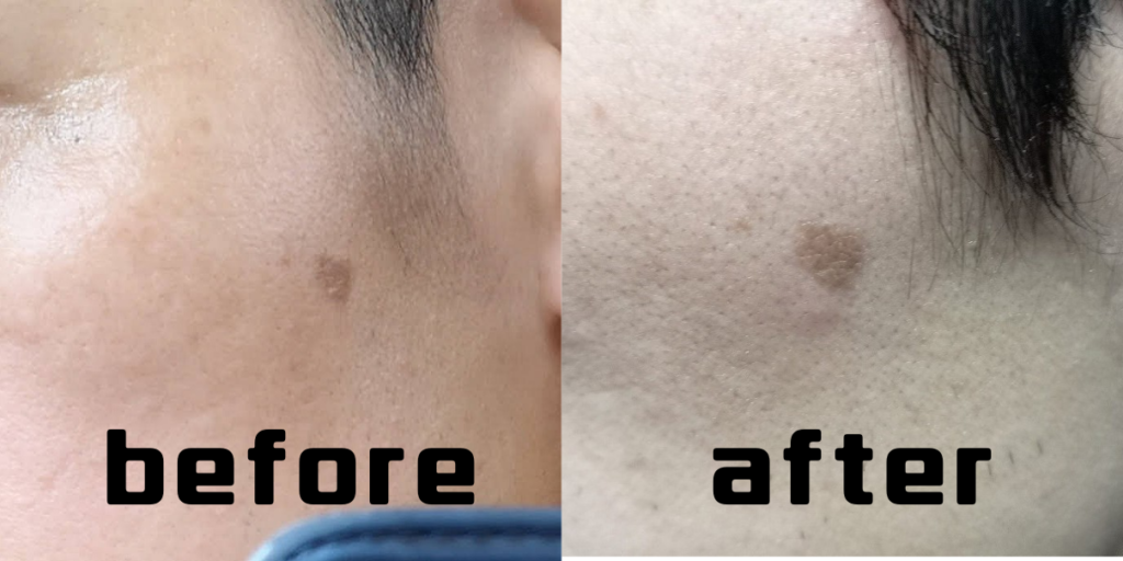 男性の美容を考えるピカメンブログ