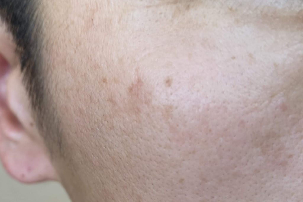 男性の美容を考えるピカメンブログ